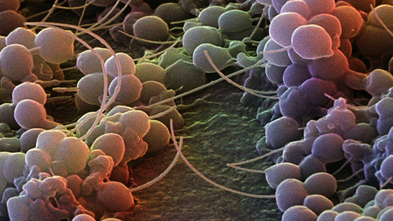 Image result for bacterien op de huid