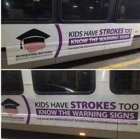 kids have strokes too